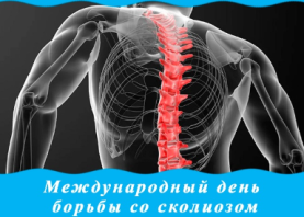 29 июня отмечается Международный день борьбы со сколиозом
